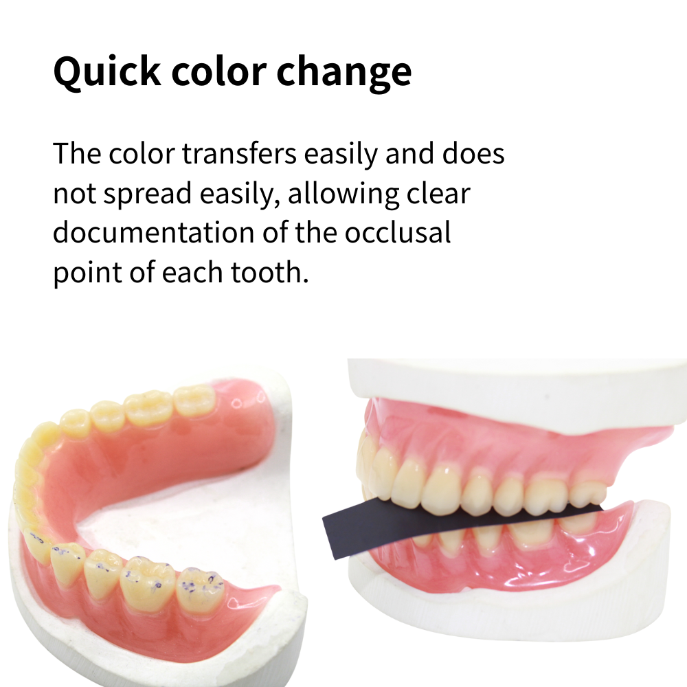 AG 300 pièces de papier occlus - Teeth Whitening Strips avis et prix